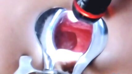Rough Anal Prolapse Whore Kittyy Fists & Farts - Must See